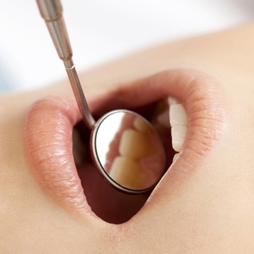 歯科矯正の経過観察中に口腔内チェックを受ける様子