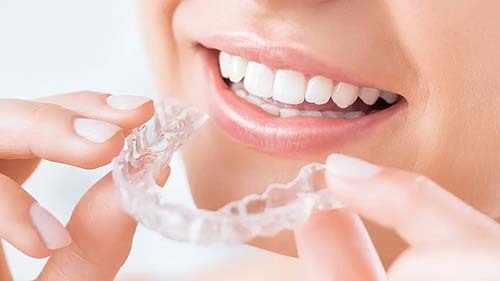 安いおすすめインビザライン 